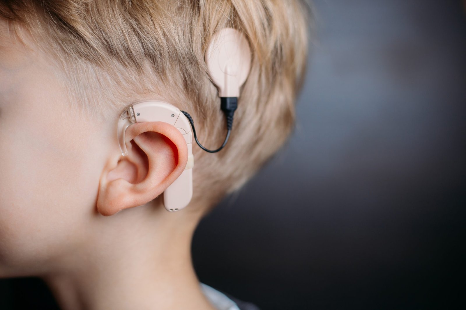 cochlear implant | MedEase | Healthcare Services in India